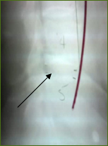 Chiropractor Atlanta Testimonial work injury Chiropractor Atlanta Testimonial work injury