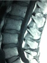 Chiropractor Atlanta Laser Treatment Chiropractor Atlanta Laser Treatment